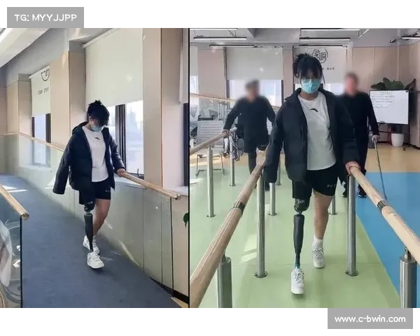 阿根廷创新自适应运动假肢获残奥委会认证 助力残疾运动员突破极限